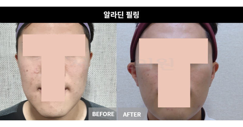 스킨케어
